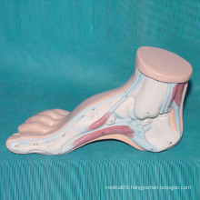 Human Bow Feet Anatomic Skeleton Model for Medical Teaching (R040111)